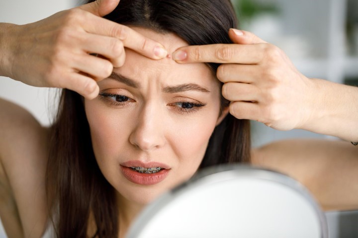 5 Effective Treatment of Acne in Ayurveda | Ayurveda Tips
