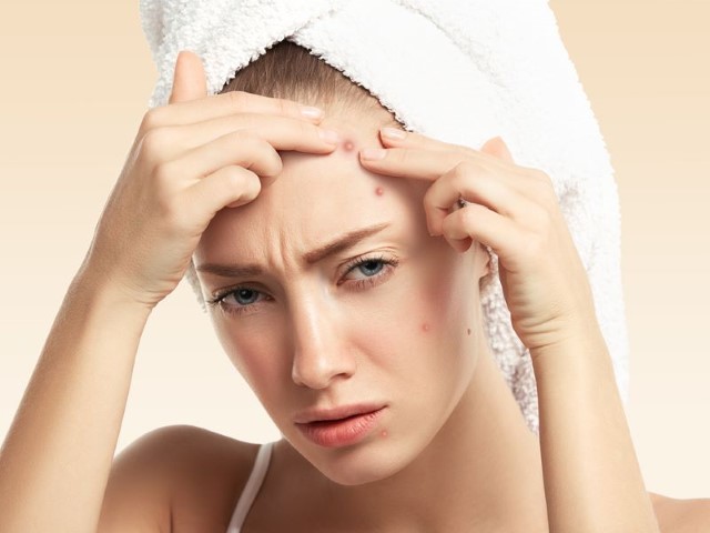 Which is the best face wash for moderate acne in India?