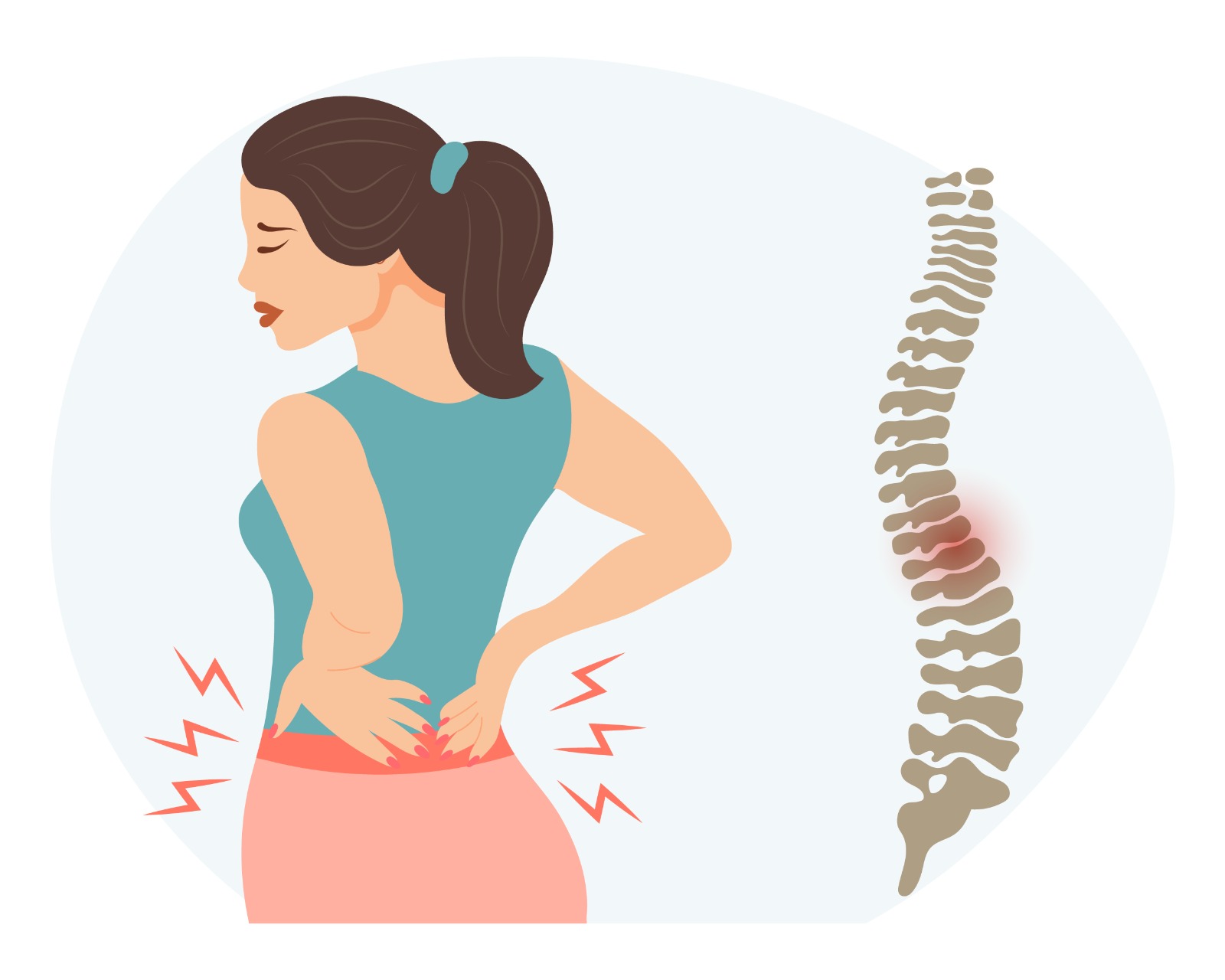 What are the symptoms of spondylitis?