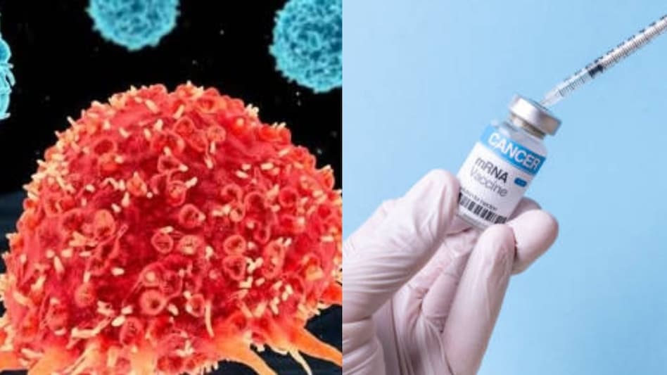 Massive breakthrough: Russia develops cancer vaccine, will distribute it for free from 2025