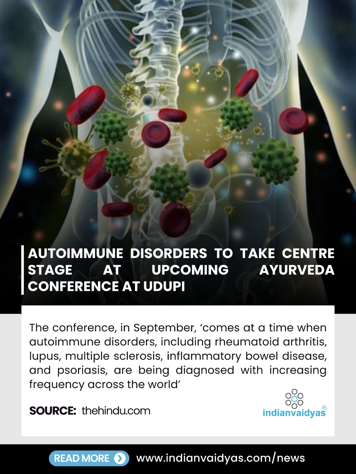 Translational Bridge: Autoimmune Disorders Take Center Stage at 'Kshamatvam 2026' International Ayurveda Conference in Udupi